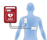 AED unit connected to a person 