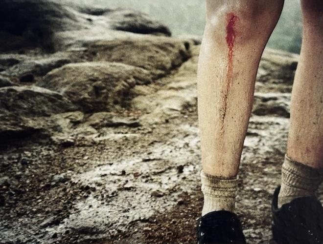 Photography by Savannah Noel featuring just the legs of a person with blood running down their shin from a knee wound.