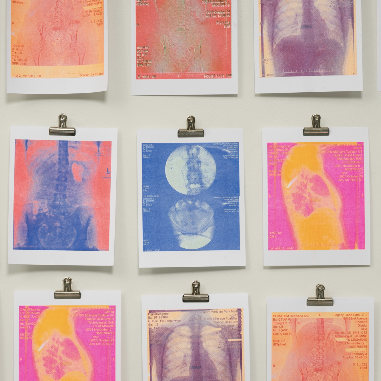 Series of risograph prints of medical x-rays