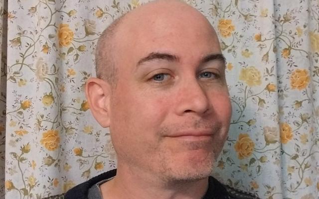 Person with no hair wearing a brown sweater, with a yellow flower curtain in the background.